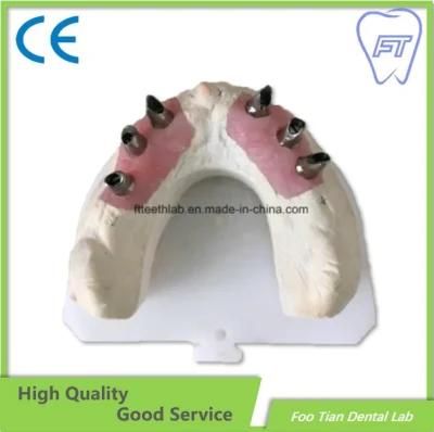 Dental Restoration Orthodontics Treatment Implant System with High Quality