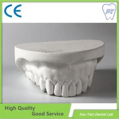 Hot Sale Removable Metal Denture Cast Partial Framework Dental