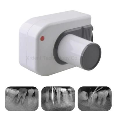 Professional Small High Frequency Portable Dental X-ray Machine