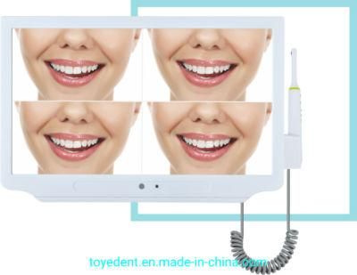 Dental Endoscope Integrated Intraoral Camera &amp; Monitor High Defination