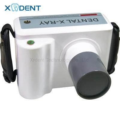 Factory Price Medical Digital High Frequency 60kv Mini Portable X Ray Machine