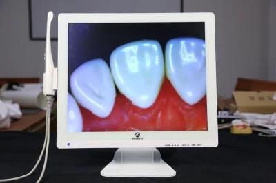 Hot Selling Multimedia Dental Camera Image Share to Smartphone Wirelessly