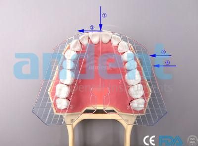 China Dental Orthodontics Instrument Guide Plate of Teeth Manufacturer