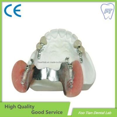 Dental Removable Solid Titanium Casting Framework Customized