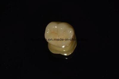 Full Contour Zirconia Crowns and Bridge