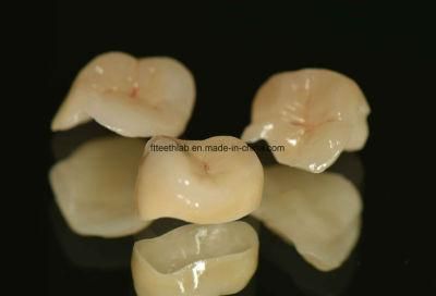 Empress E-Max Inlay&Onlay Made in China Dental Lab