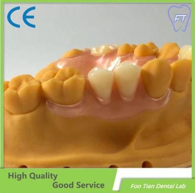 Removable Denture Cobalt Chrome Casting Framework Customized