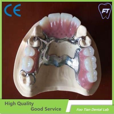 Dental Cobalt Chrome Casting Framework Denture on Selling