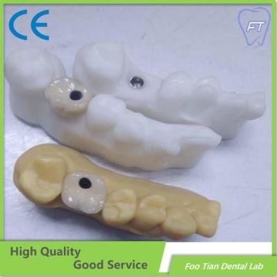 Dental Zirconium Bridges From China Dental Lab on Selling