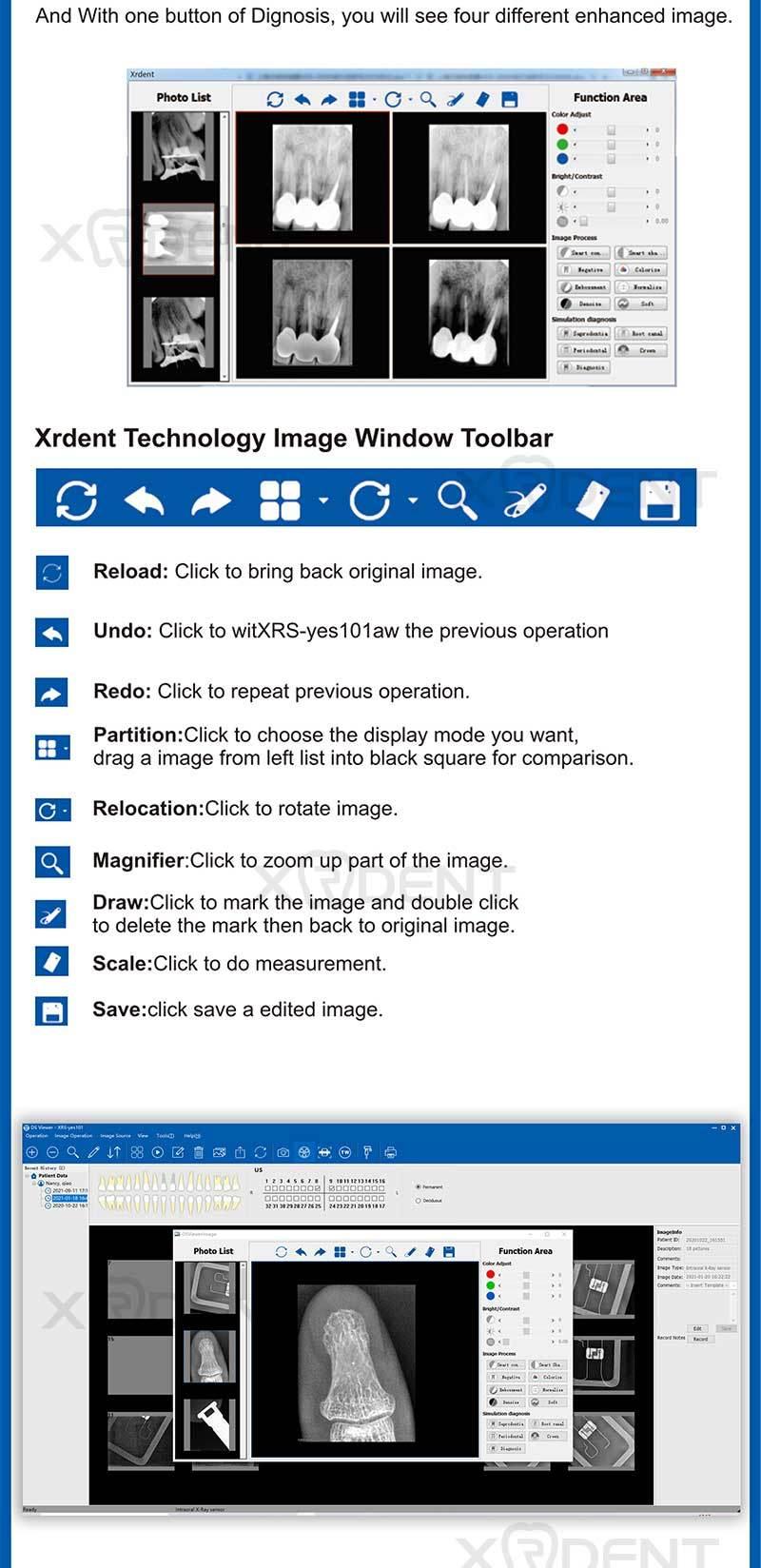 Dental Rvg Sensor Vatech Intra-Oral Imaging Systems