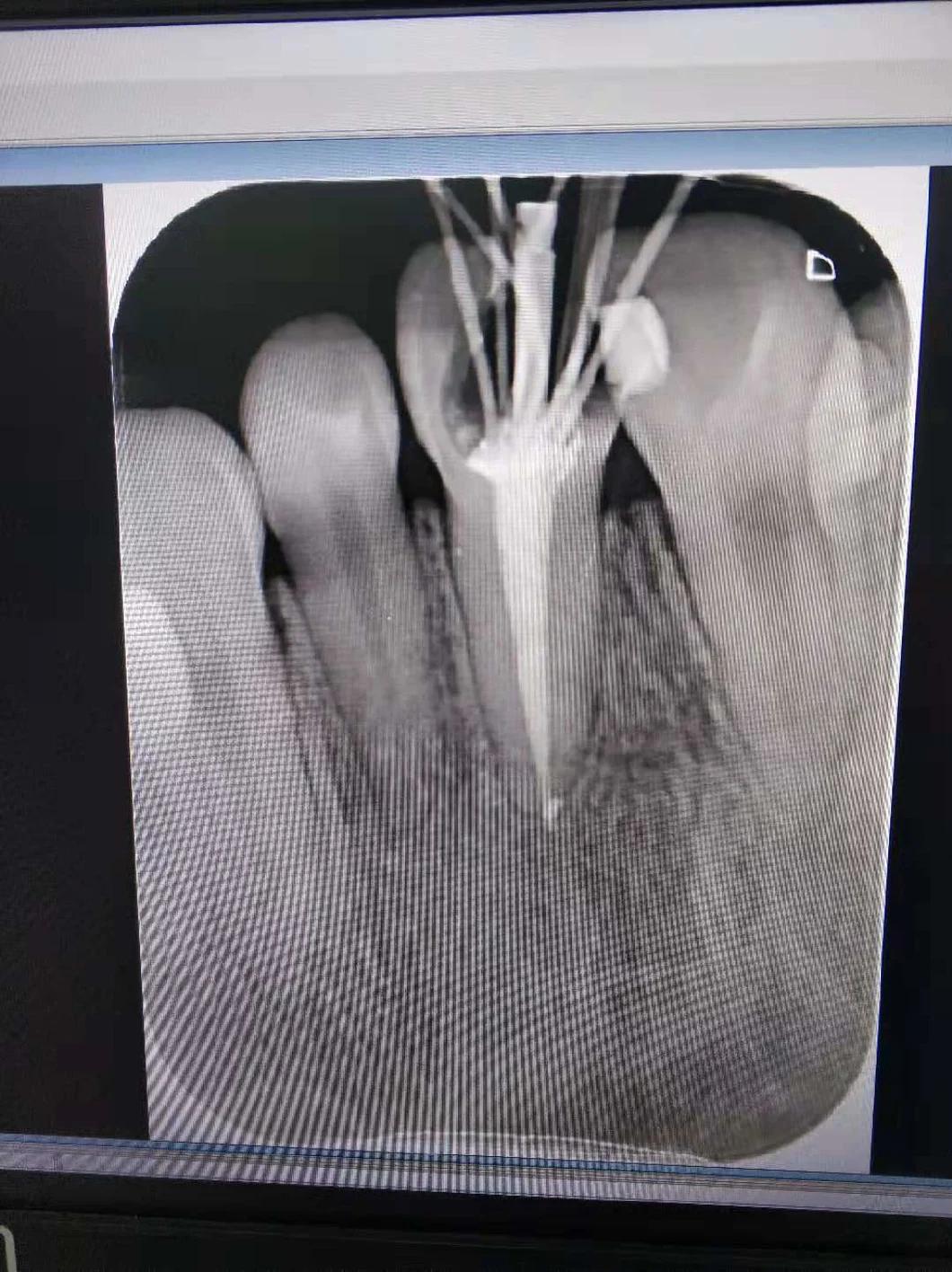 Portable Dental Handheld X-ray Unit with Factory Price