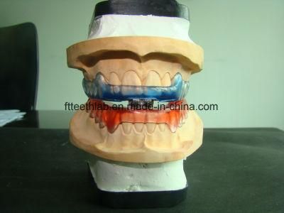 Comfortable Sleep Apnea Appliance Made in China Dental Lab From Shenzhen China