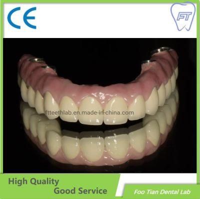 Hybrid Implant Denture Dental Implant Nobel Dentistry on Selling