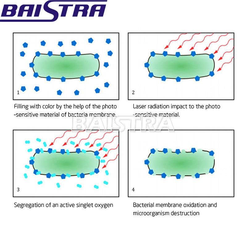 Baistra Portable F3ww Pad Dental Low Level Laser/ Dental Soft Tissue Laser