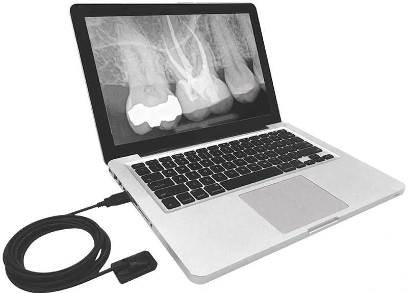 Red Color Dental X Ray Camera Equipment for Clinic