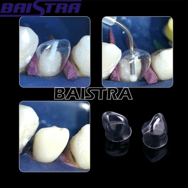 Baistra Dental Supplies Teeth Crowns Anterior Transparent Crowns Kit