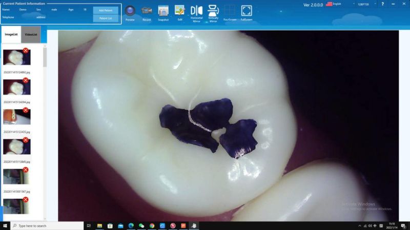 Wired Dental Camera USB Oral Imaging System