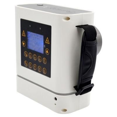 Most Popular Portable X-ray Machine Loved by Dentists Discount