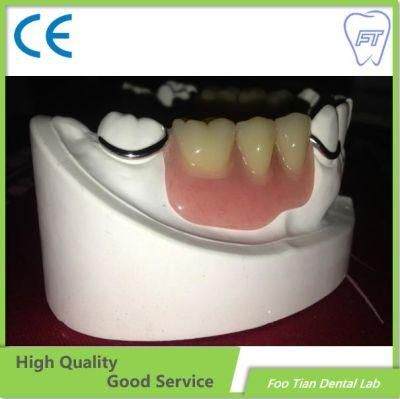 Customized Dental Cobalt Chrome Casting Framework Denture