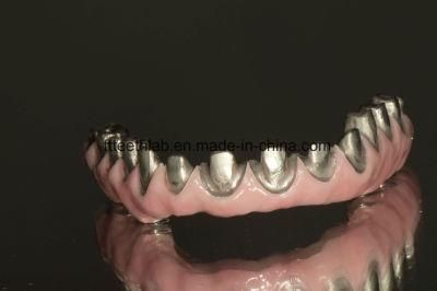 Full Mouth Implant Bridge Made From China Dental Lab