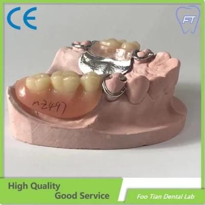 Cobalt Chrome Casting Framework Removable Denture Customized