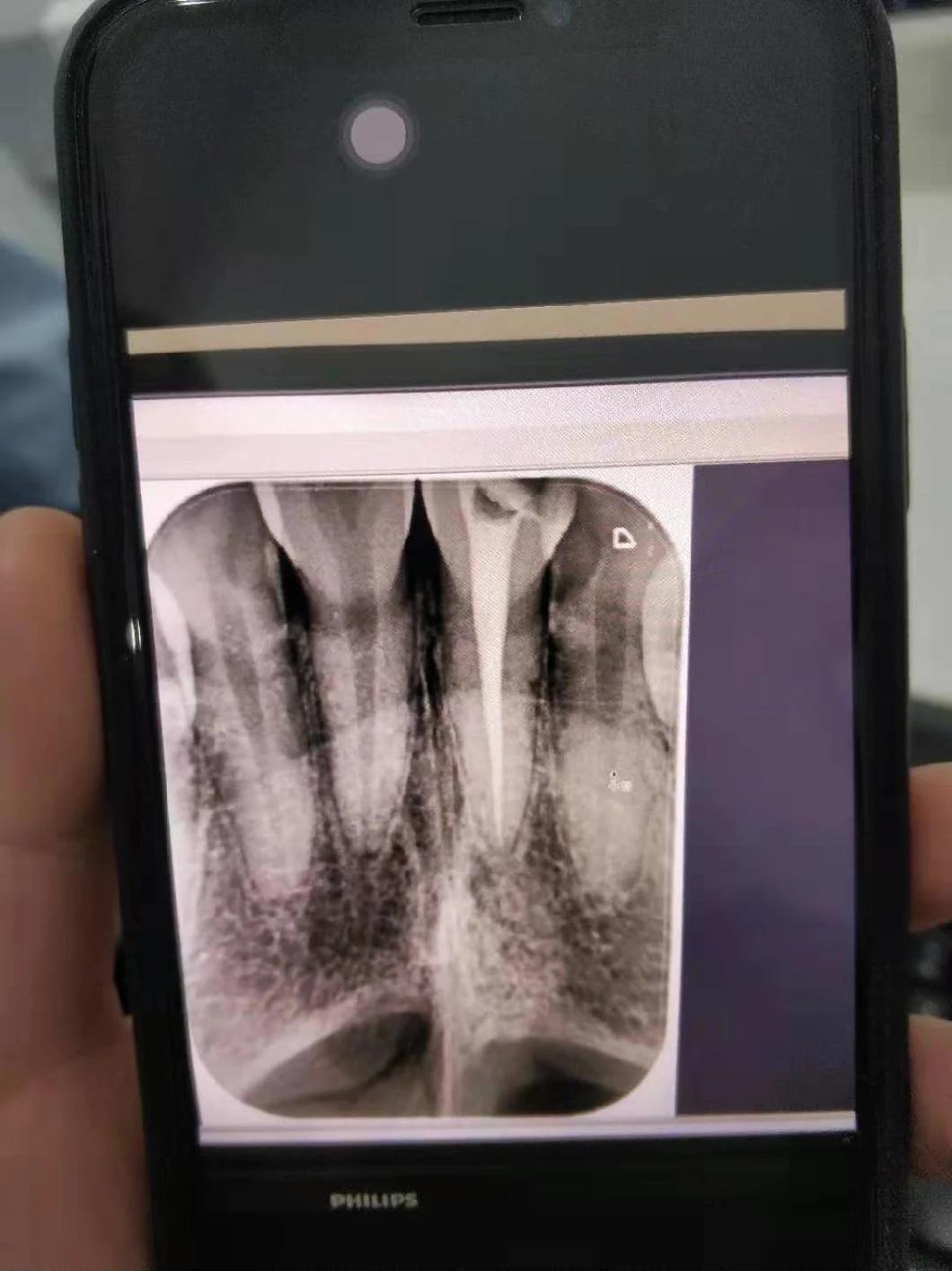 Mini Portable Dental Digital X-ray Machine