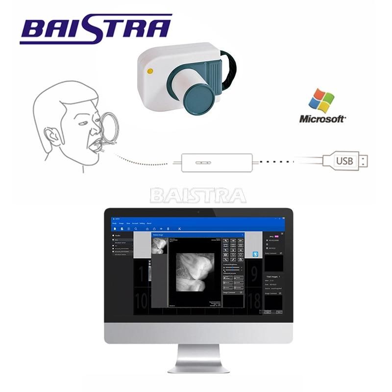 Hot Selling Dental X-ray Digital Image Rvg Sensor