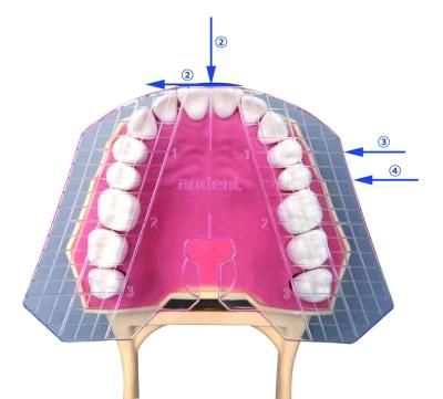 Guide Plate of Teeth of China Factory