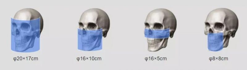 Hires 3D-Plus CE Professional Large Fov Dental 3D Cone Beam Computred Tomography Cbct Equipment