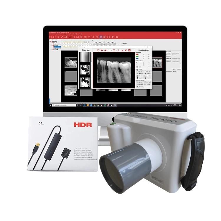 Dental Portable Digital Wireless Dental X-ray with Sensor