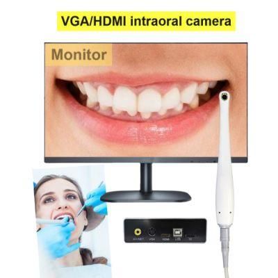 Hot Selling Metal Shell Intraoral Camera System Working with TV/Monitor