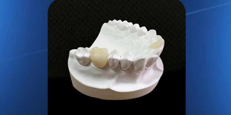 Medical Dental Material Manufacturer Economical Dental Lab Zirconia Blocks, Zirconium Blocks, Zirconia Disc, Zircounium Blank, Zircounia Disc