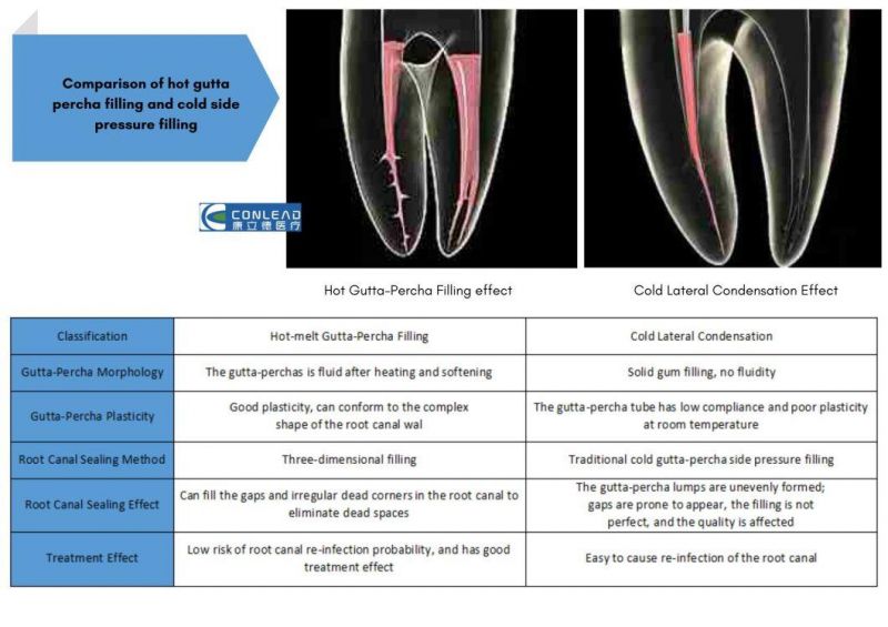 Ultimate Gutta-Percha Obturation System for Root Canal Procedures, Includes Heat & Packing Pen and Hot Melting & Filing Gun