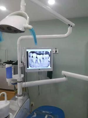 Digital Dental Intraoral Camera Image Wirelessly Transfer to Patient