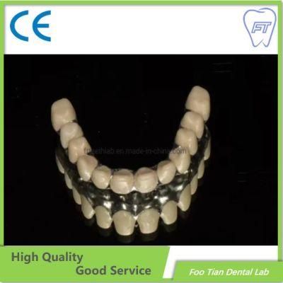 Customized Dental Cobalt Chrome Casting Framework