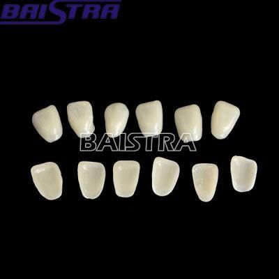 Dental Temporary Crown Material Veneer Resin Teeth