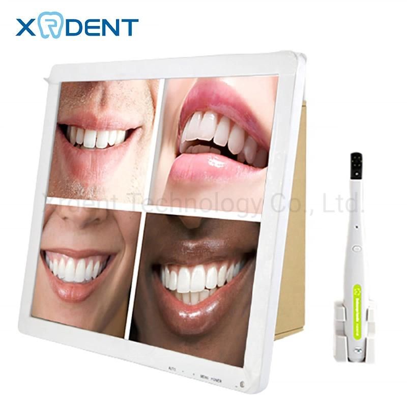 WiFi Function Dental Intraoral Camera with 17 Inch Monitor