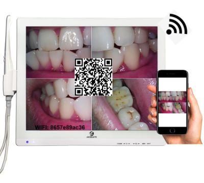 Most Cost-Effective High Pixel Dental Intraoral Camera with 10 LEDs