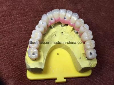 Dental Material Lab Implant Dental Lab Custom Full House Zirconia Implant Bridge From China