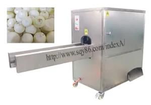 Commercial Big Onions Peeling Topping and Tailing Equipment 60mm-100mm