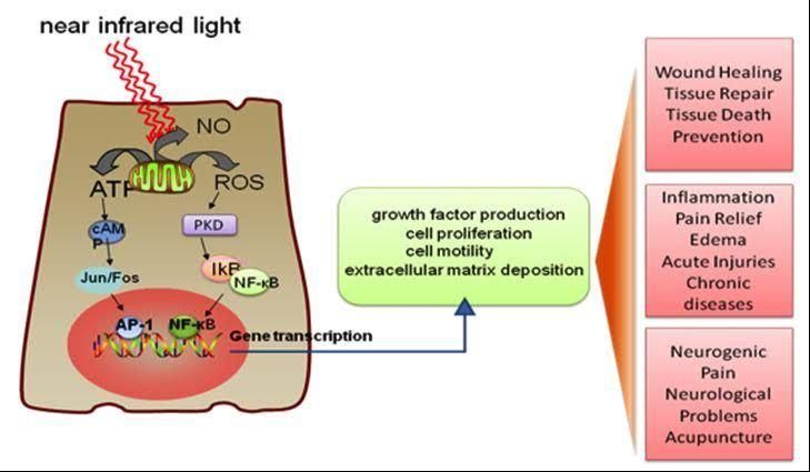 FDA Cleared Light Therapy for Pain Relief Local Wrap