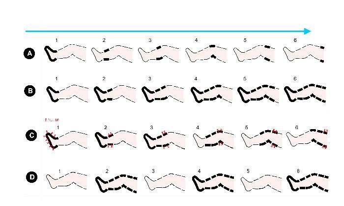 Physio Recovery Pump Boots System Has a Sequential Squeezing From Distal to Proximal